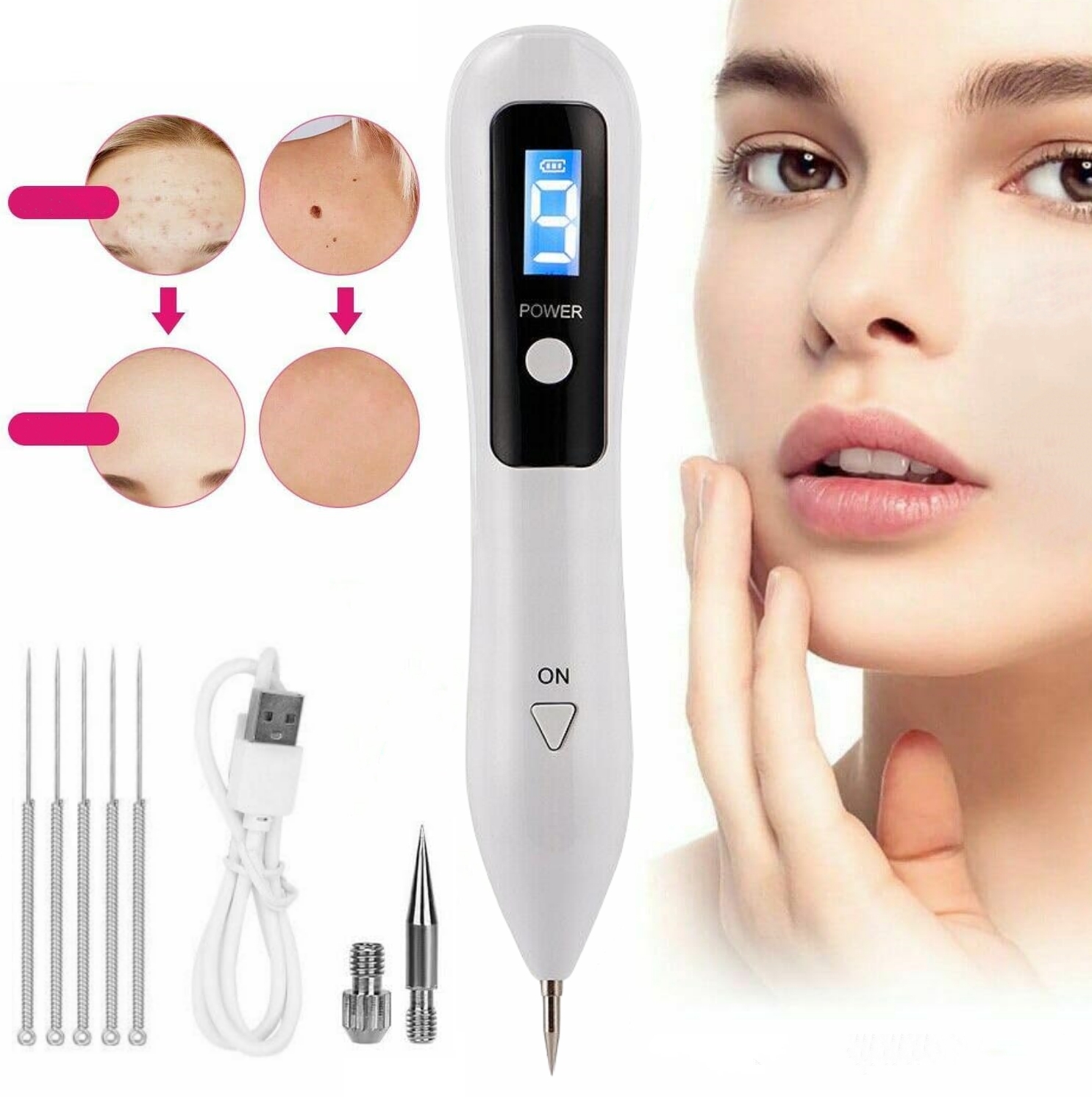 PLASMA PEN PLAZMA LASEROWE USUWANIE BLIZN TATUAŻY BRODAWEK PIEPRZYKÓW Kolor dominujący biały