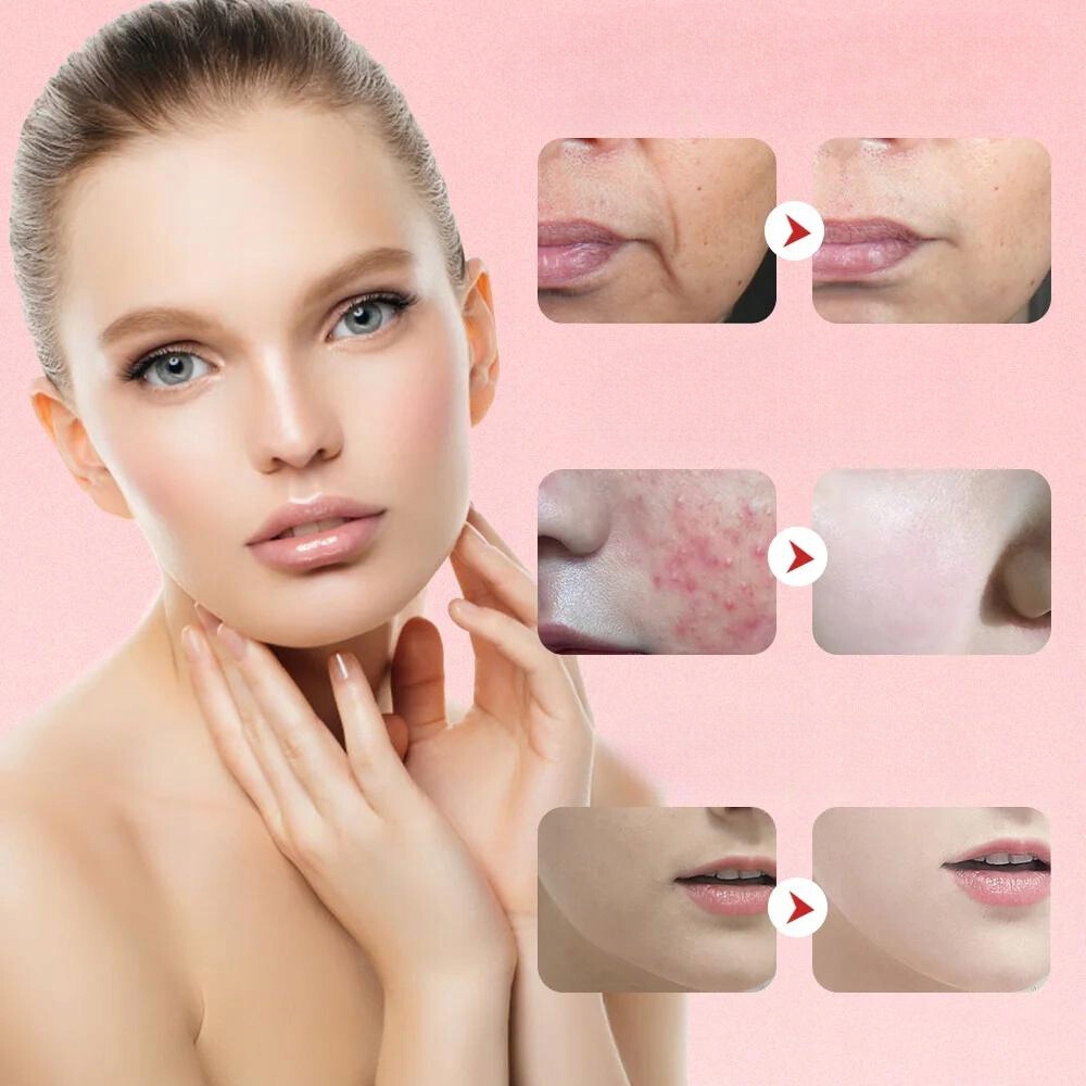 Masażer Twarzy 7w1 Mezoterapia EMS Lifting LED Jonoforeza Bezigłowy Model 7in1