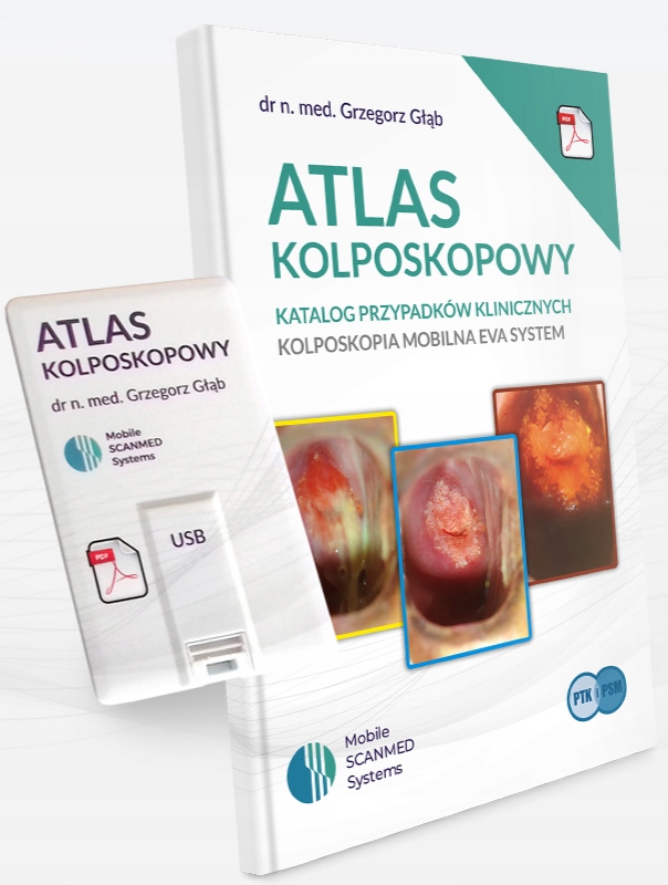 

Atlas Kolposkopowy- Katalog Przypadków Pendrive