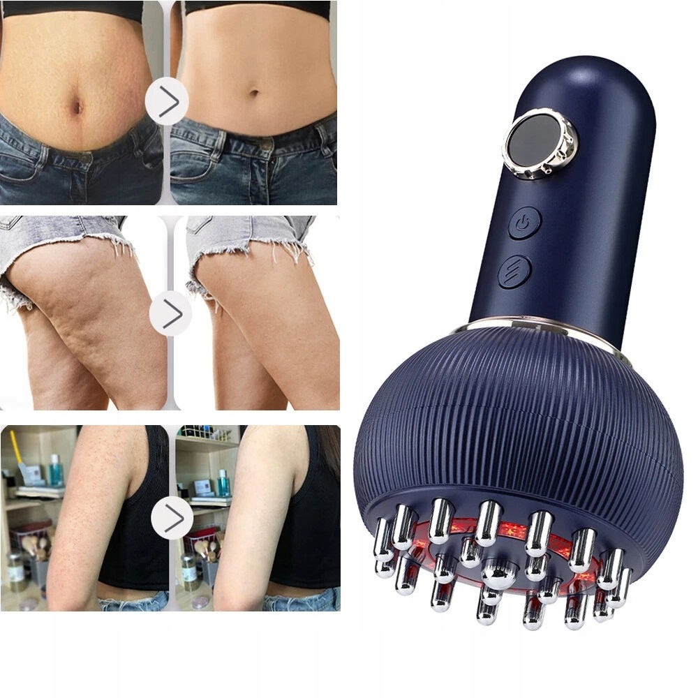 Elektryczna Bańka Chińska Z Podgrzewaniem – Masażer Próżniowy Na Cellulit