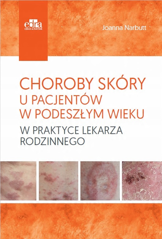 

Choroby Skóry U Pacjentów W Podeszłym Wieku W Prak