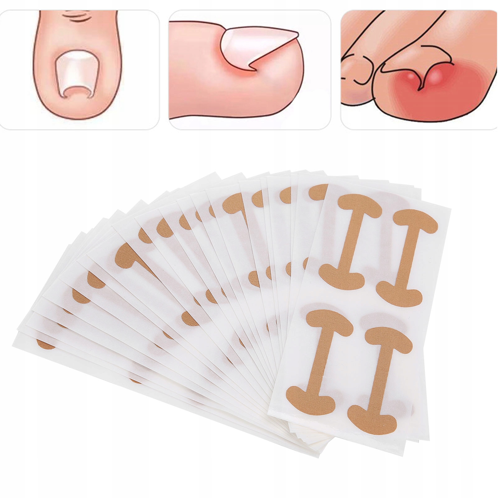 ZESTAW NA WRASTAJĄCE PAZNOKCIE KLAMRA KOREKTOR Kod producenta 308929