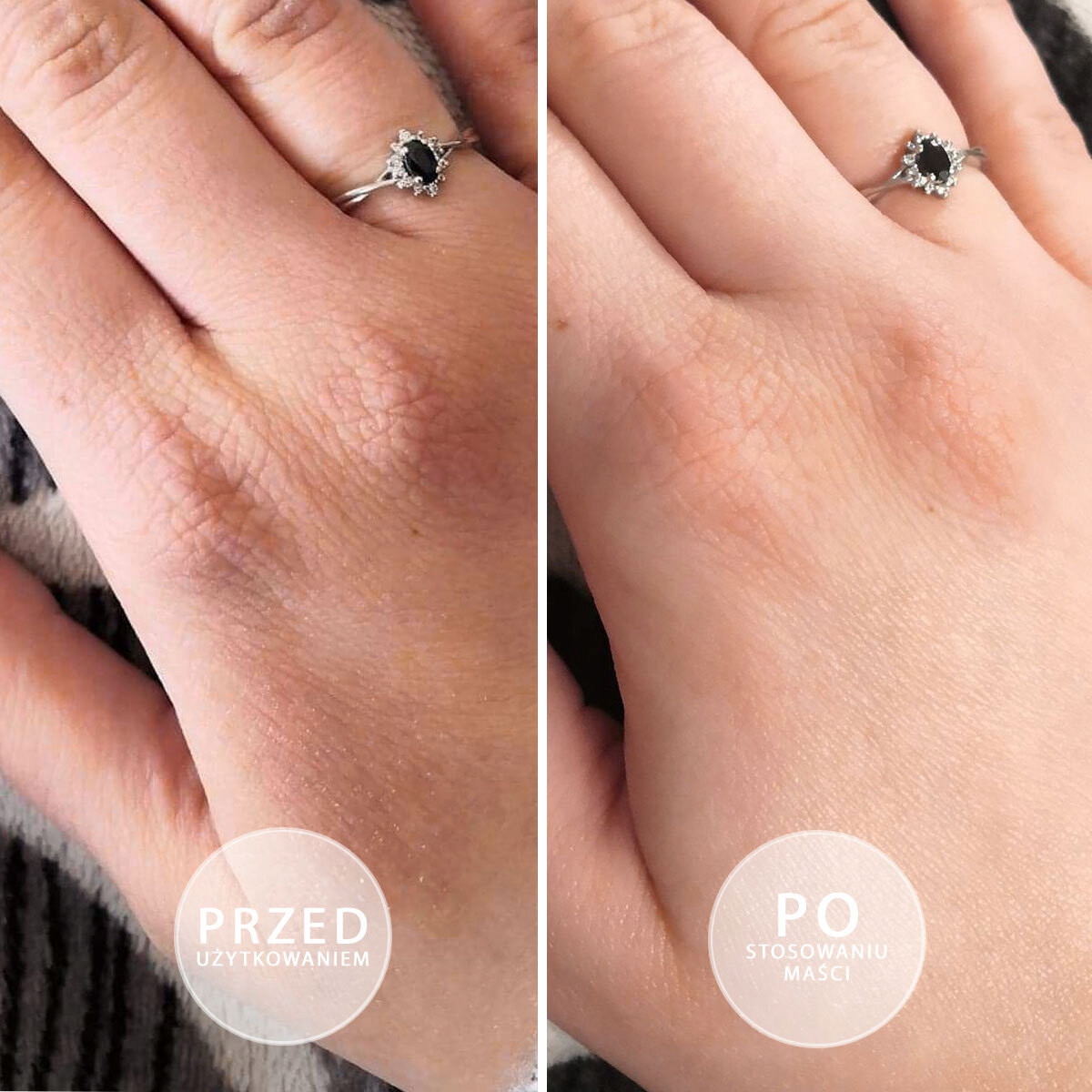 Maść z witaminą E do rąk, do skóry suchej BEAUTICA natłuszczająca SOS 100ml Pojemność 100 ml