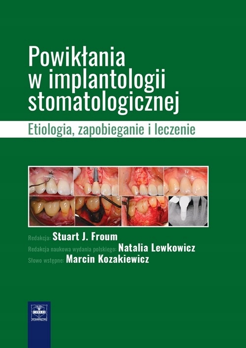 

Powikłania W Implantologii Stomatologicznej