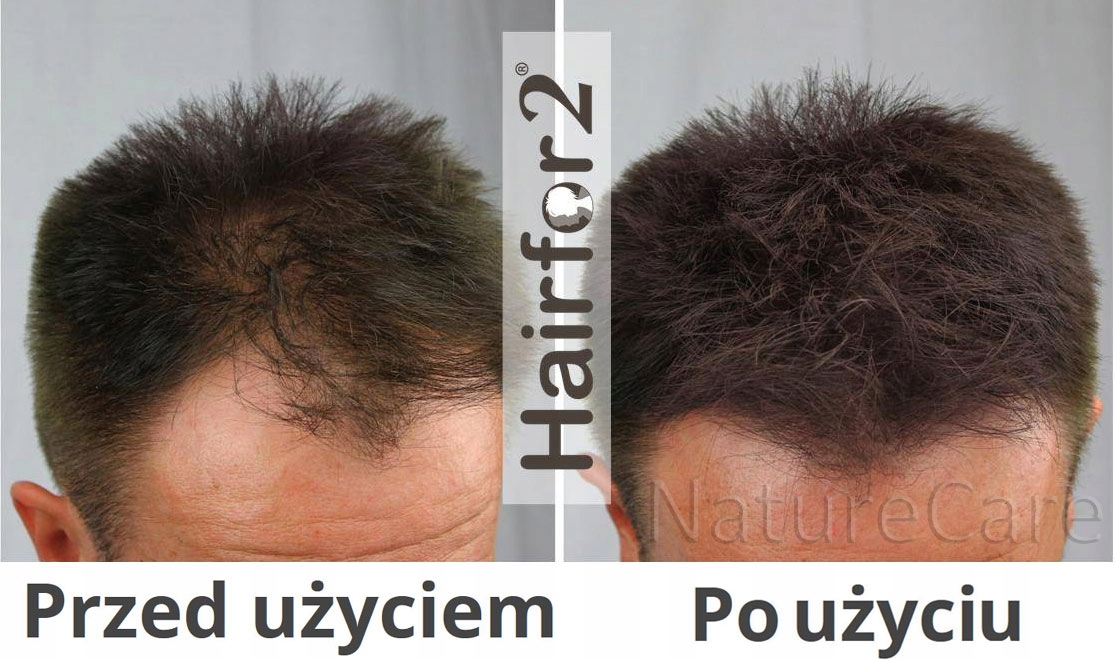 HairFor2 Mikrowłókna w Sprayu 400ml Zagęszczanie Wielkość Produkt pełnowymiarowy