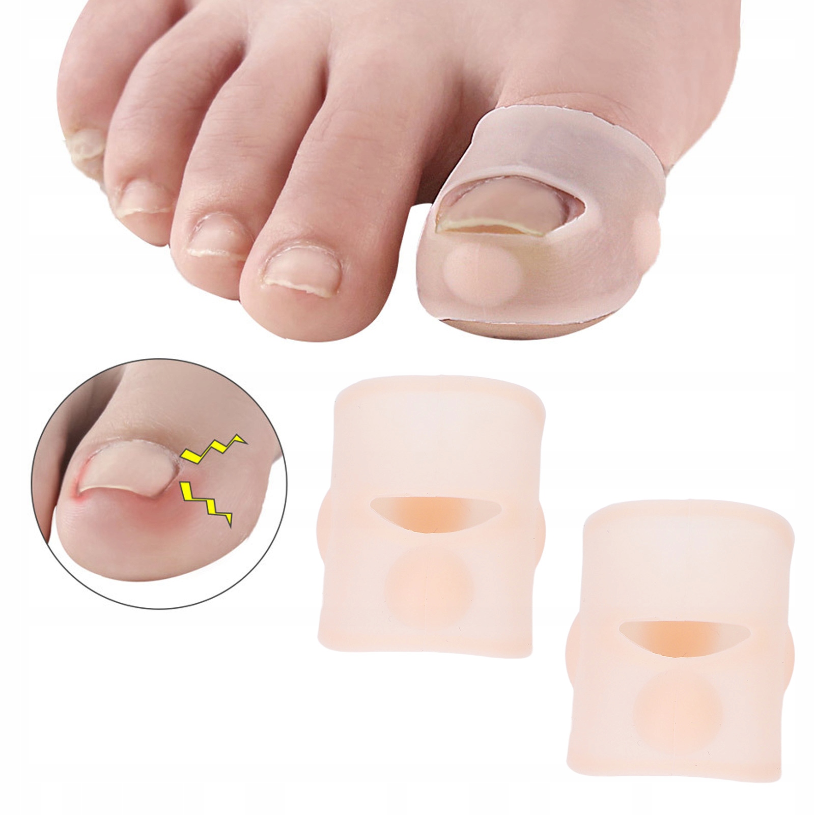 KOREKCJA WRASTAJĄCYCH PAZNOKCI SILIKON 3*2CM