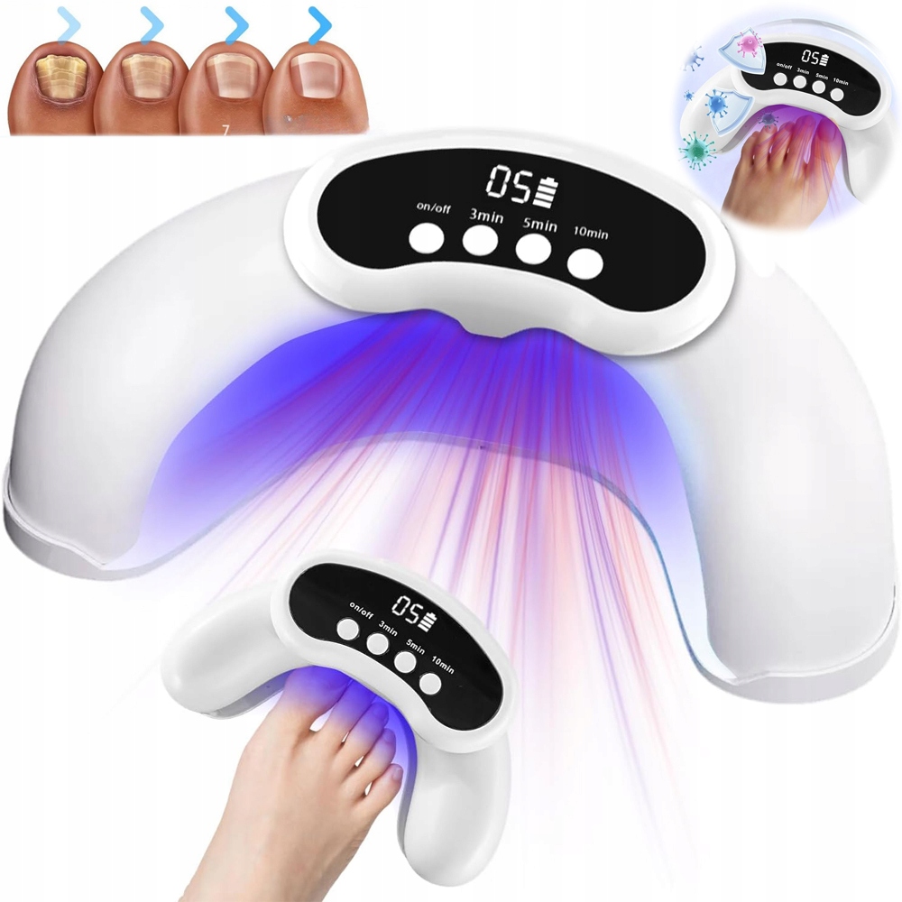 Laserové Zařízení Pro Léčbu Onychomykózy (plísně Nehtů) Na Nehtech Rukou A Nohou