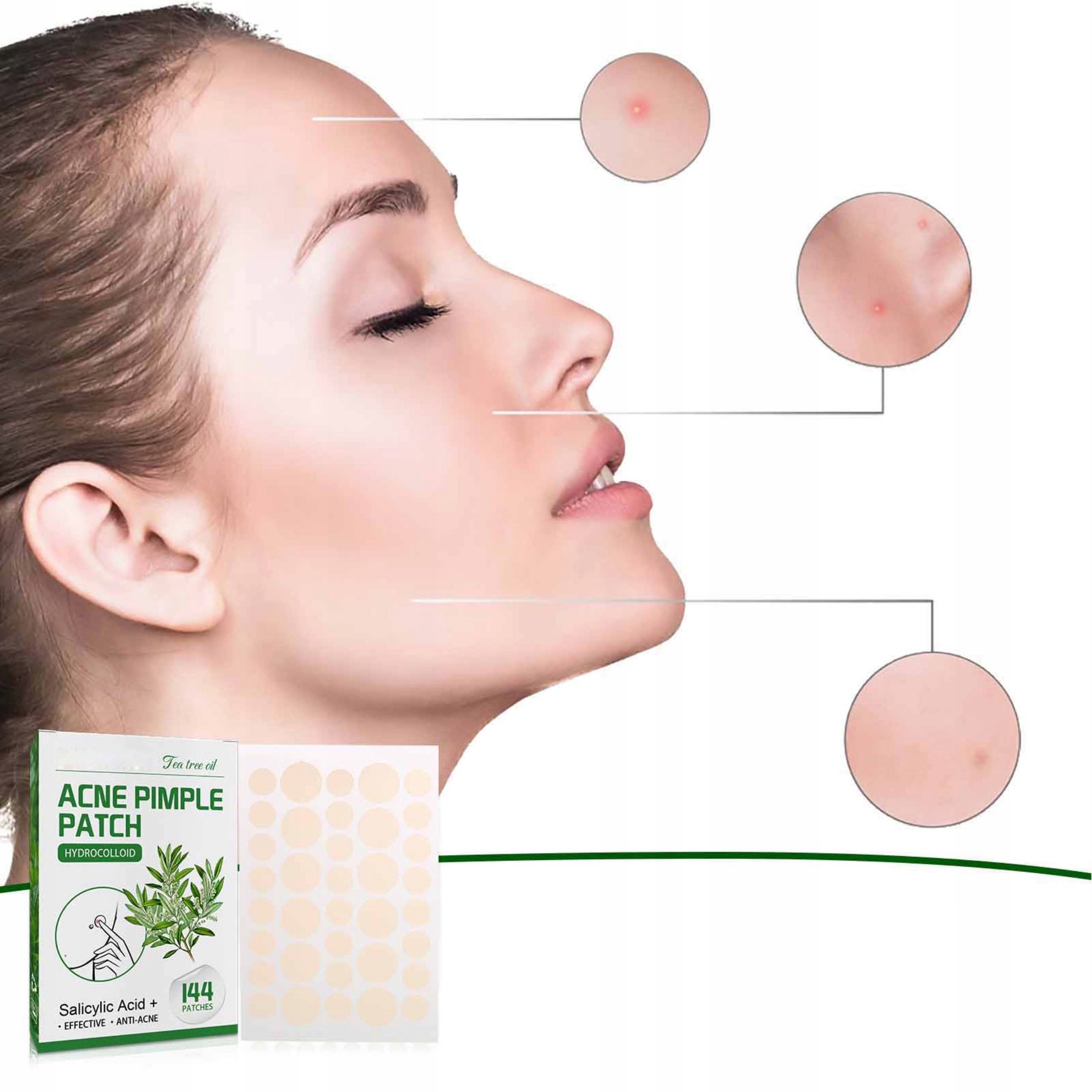 ACNE PLASTERKI NA WYPRYSKI 144 SZT Marka bez marki
