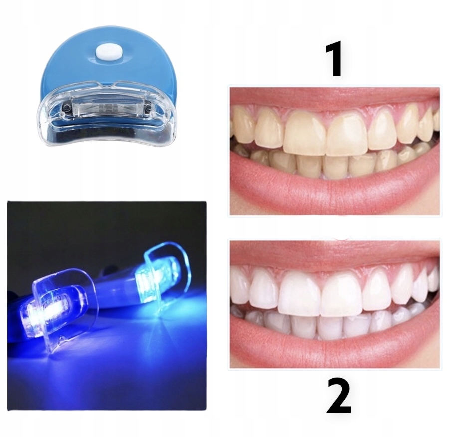 Уф отбеливание зубов. Ультрафиолетовая лампа для зубов. Лампа для отбеливания зубов. Led-лампы отбеливания. Лед лампа для отбеливания зубов.