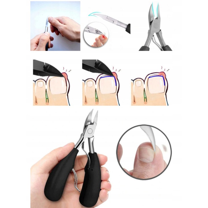 ZESTAW NA WRASTAJĄCE PAZNOKCIE KOREKCYJNY KLAMRA Rodzaj zestaw