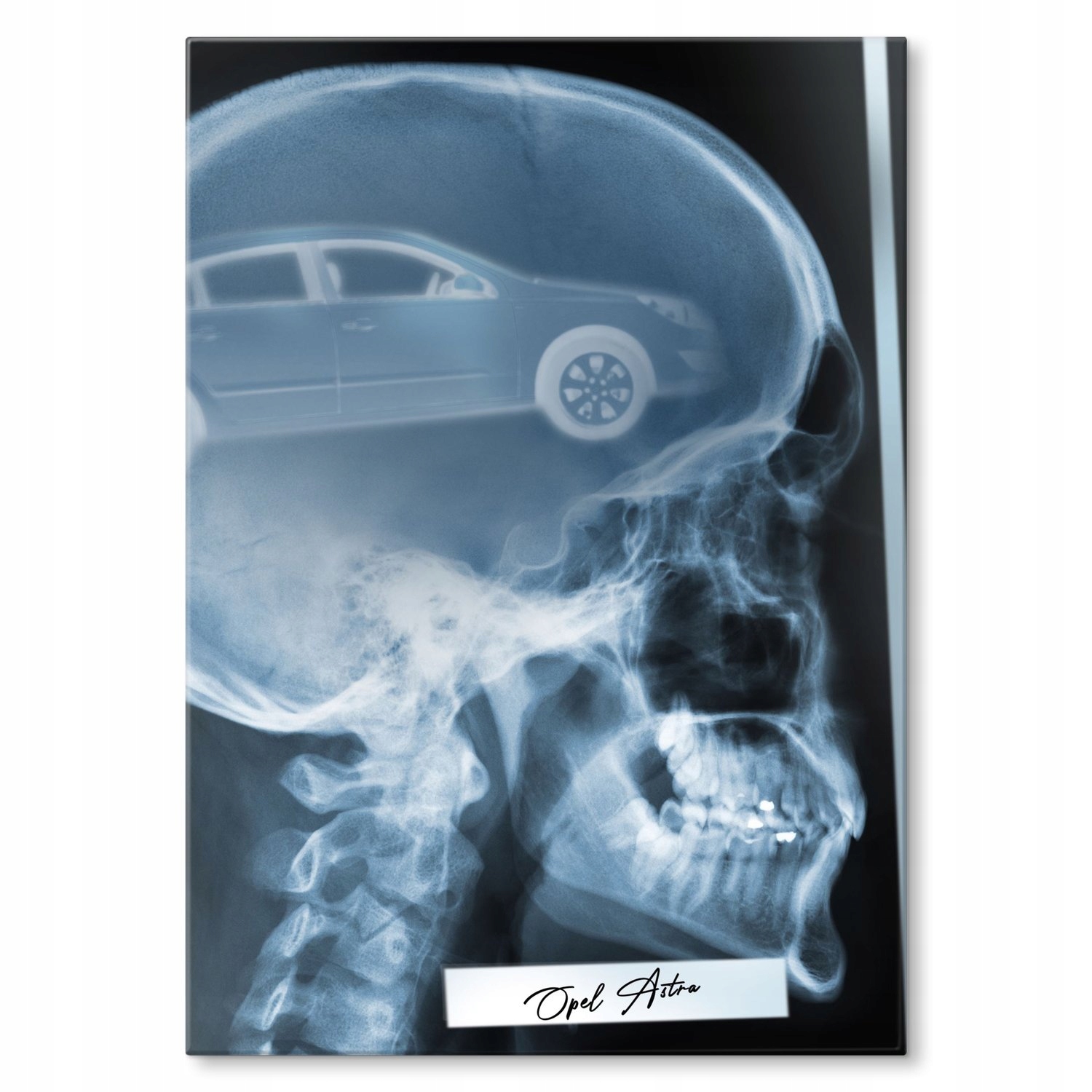 

Plakat metalowy Rentgen Opel Astra H S