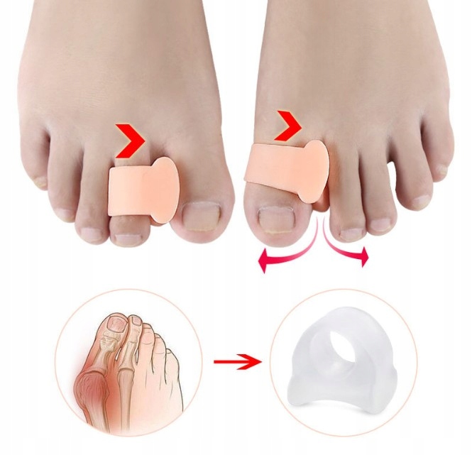 

Kliny Haluksy Separatory Żelowe Aparat Orteza Lcie