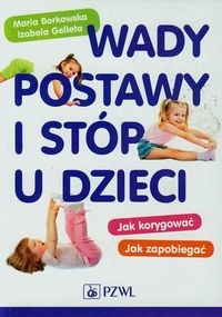 Wady Postawy I Stóp U Dzieci Maria..