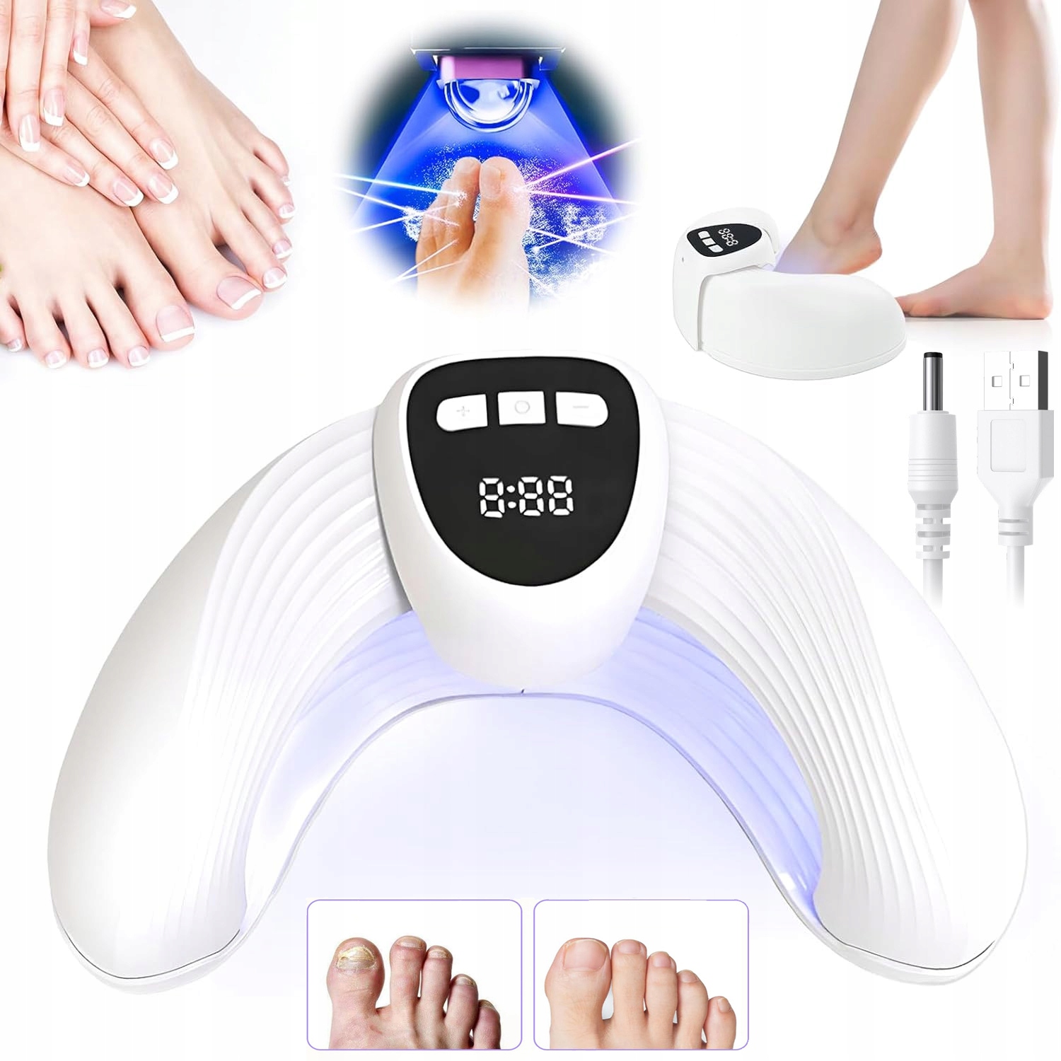 Protiplísňové Laserové Zařízení Pro Léčbu Mykózy Nehtů Na Nohou 45W