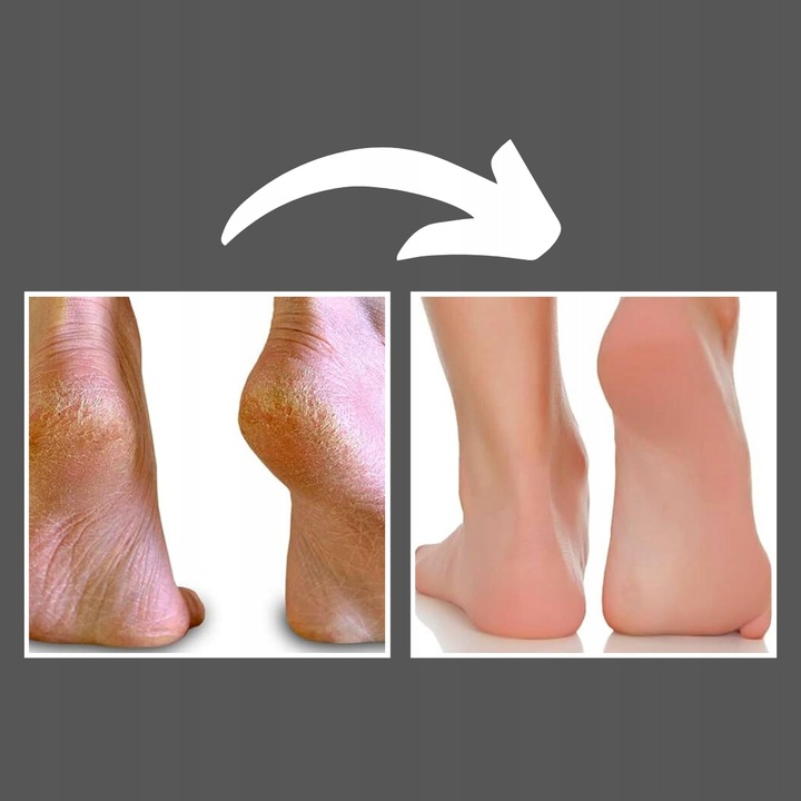 SILIKONOWA SZCZOTKA DO MYCIA PLECÓW STÓP MYJKA MASAŻER POD PRYSZNIC WANNY Rodzaj myjka