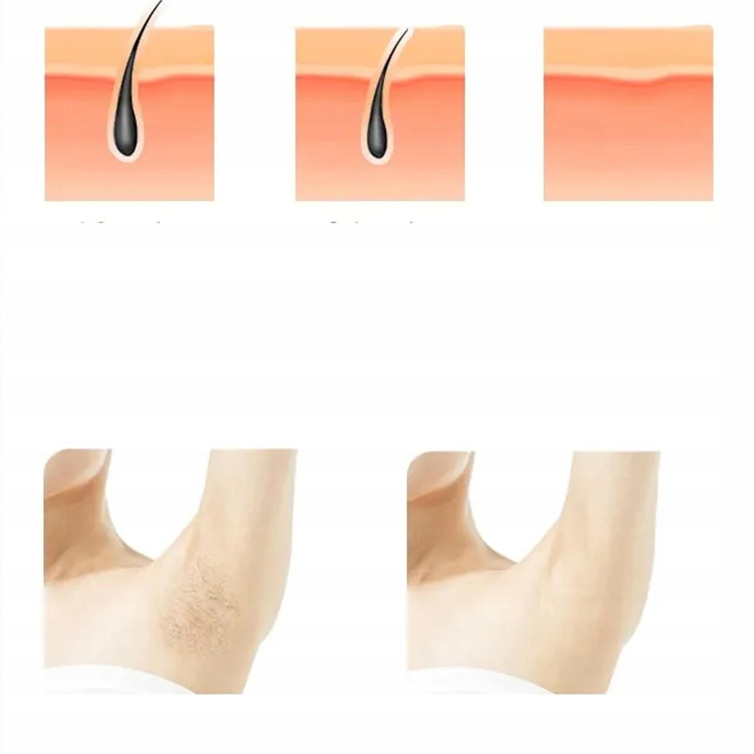 DEPILATOR LASEROWY IPL DO CIAŁA NÓG BIKINI BEZBOLESNY PREMIUM Zasilanie sieciowe