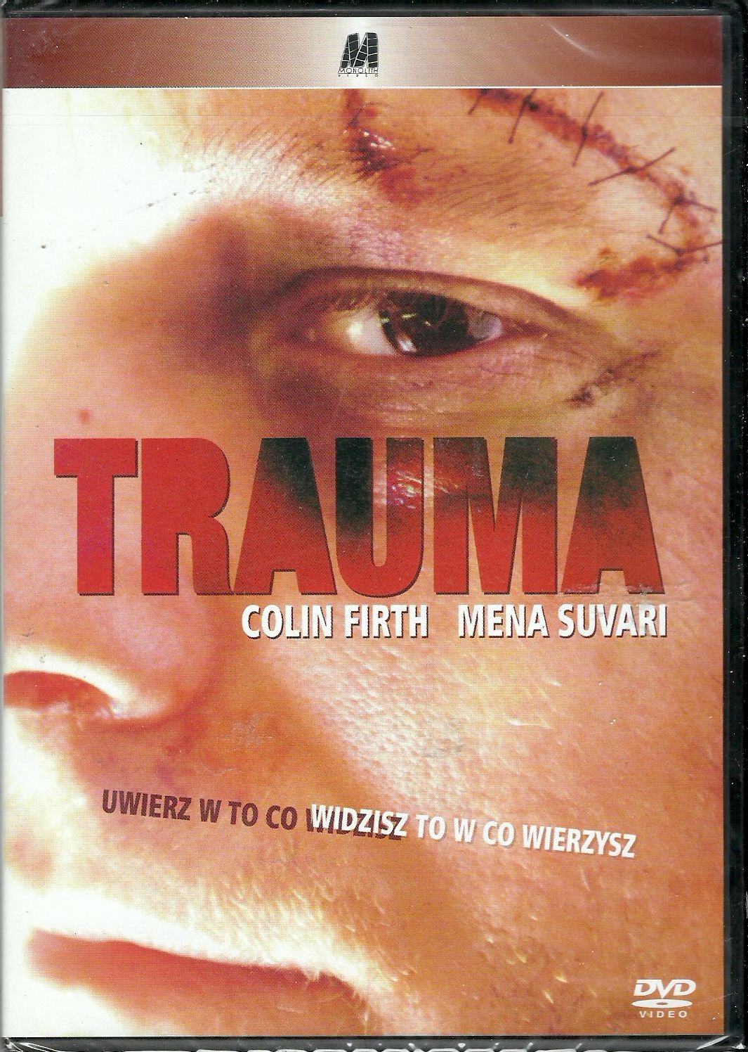 TRAUMA