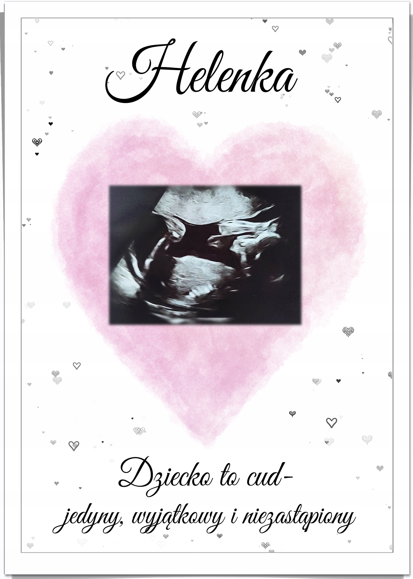 

Plakat pamiątka zdjęcie Usg dziecka w2 Ramka A4