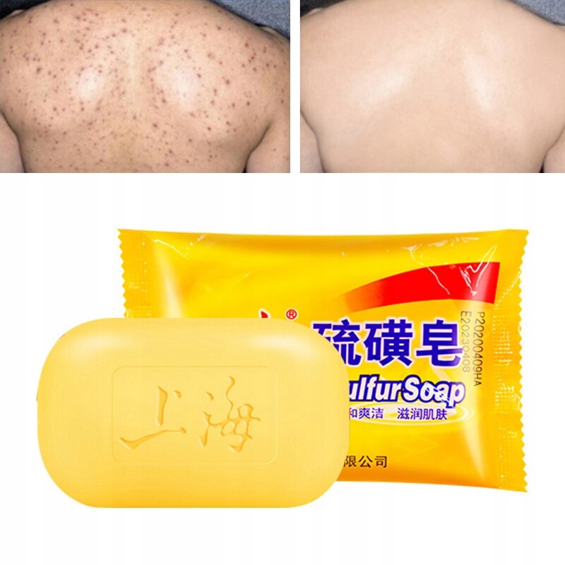 1pcs Shanghai Sulfur Soap 85g Oil-Control Acne