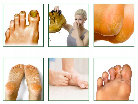 ZŁUSZCZAJĄCA MASKA DO STÓP TYPU SKARPETKA USUWA MARTWY NASKÓREK 1 PARA Marka inna marka