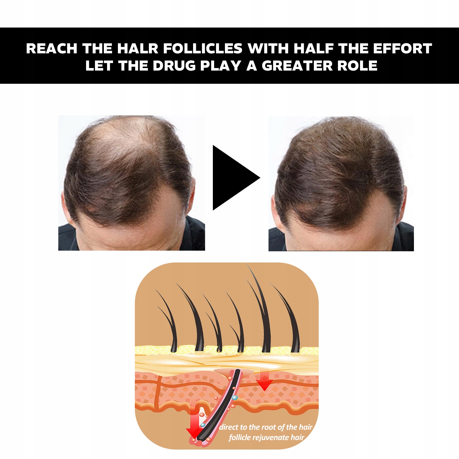 Płyn do pielęgnacji włosów Polygonum multiflorum, przeciw wypadaniu włosów Rodzaj wcierka
