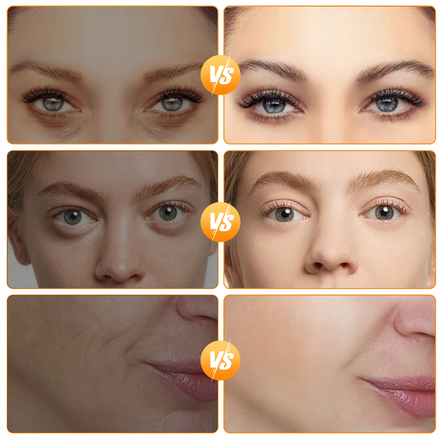 MEZOTERAPIA BEZIGŁOWA 7w1 MASAŻER TWARZY ELEKTRYCZNY EMS LIFTING LED Marka ZeeTech