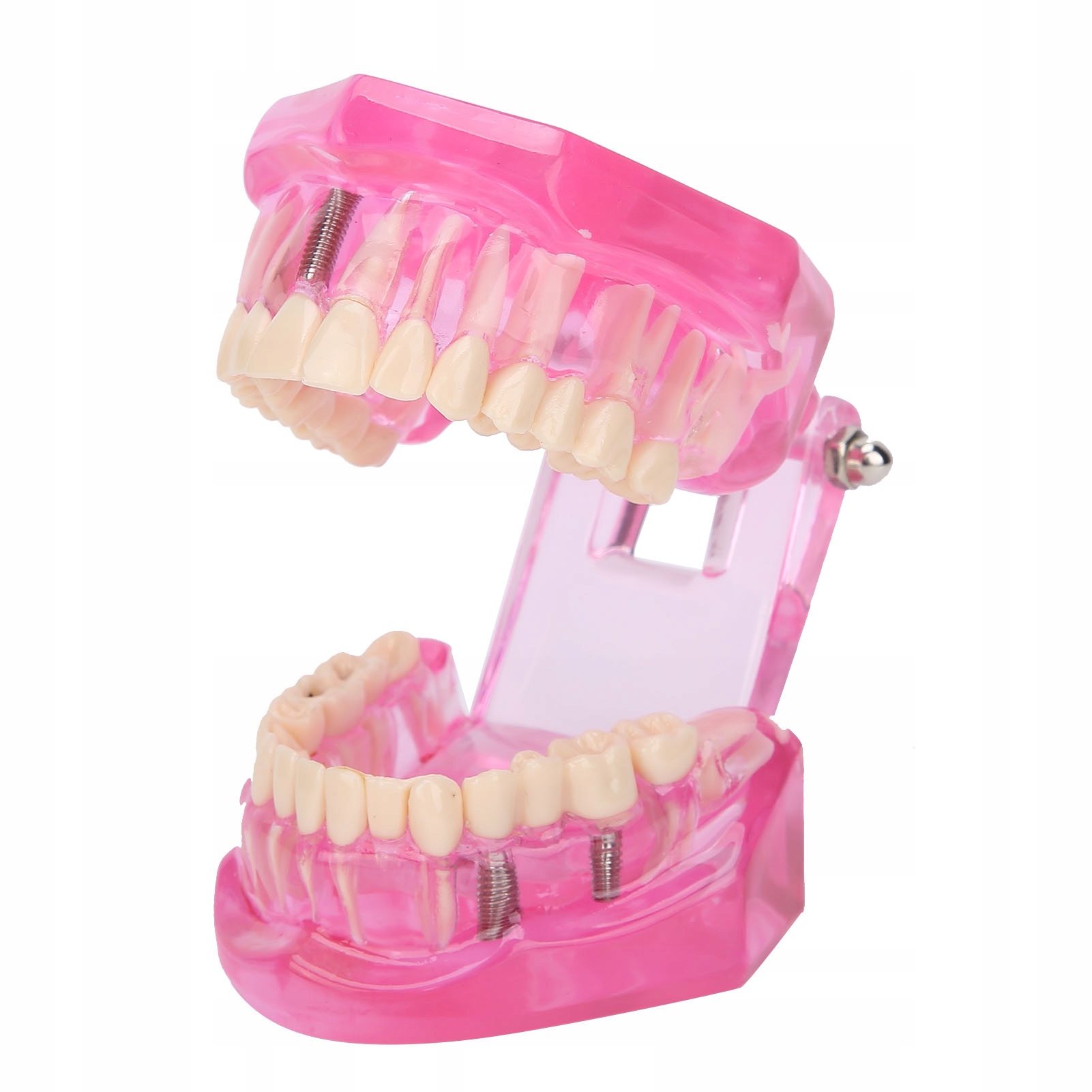 Implanty Dentystyczne Model Zębów Dentysta