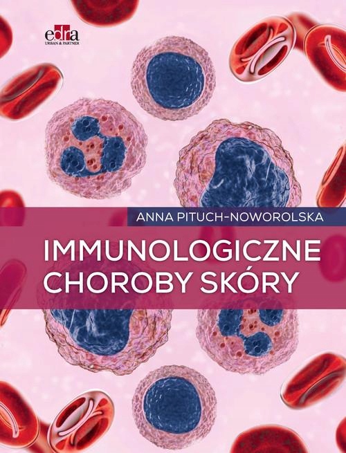

Immunologiczne Choroby Skóry