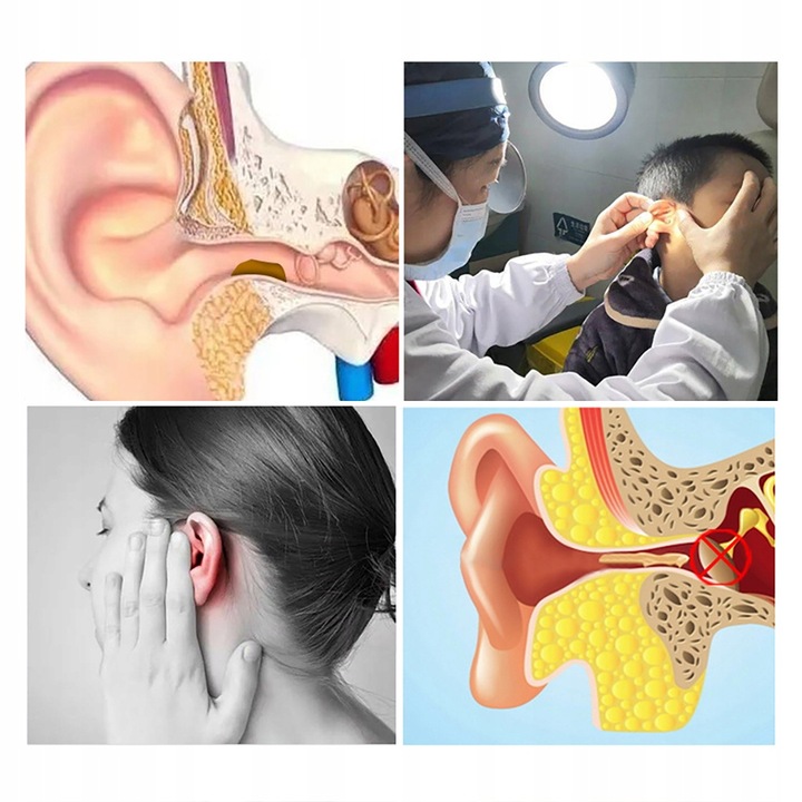 SMART OTOSKOP KAMERA CZYSZCZENIE USZU WOSK WIFI HD APLIKACJA ENDOSKOP CE EAN (GTIN) 3615612800855