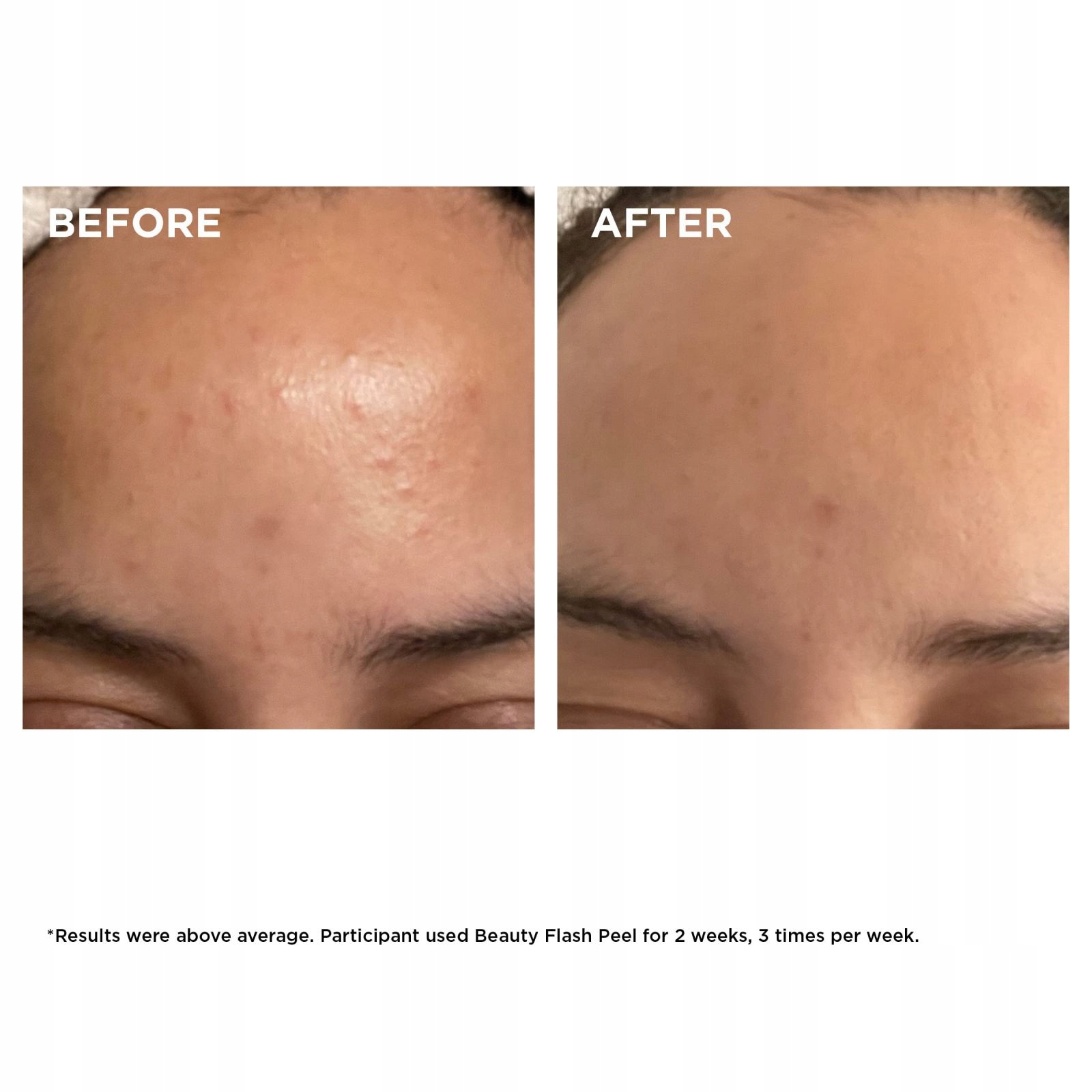 Clarins (beauty Flash Peel) 50 ML