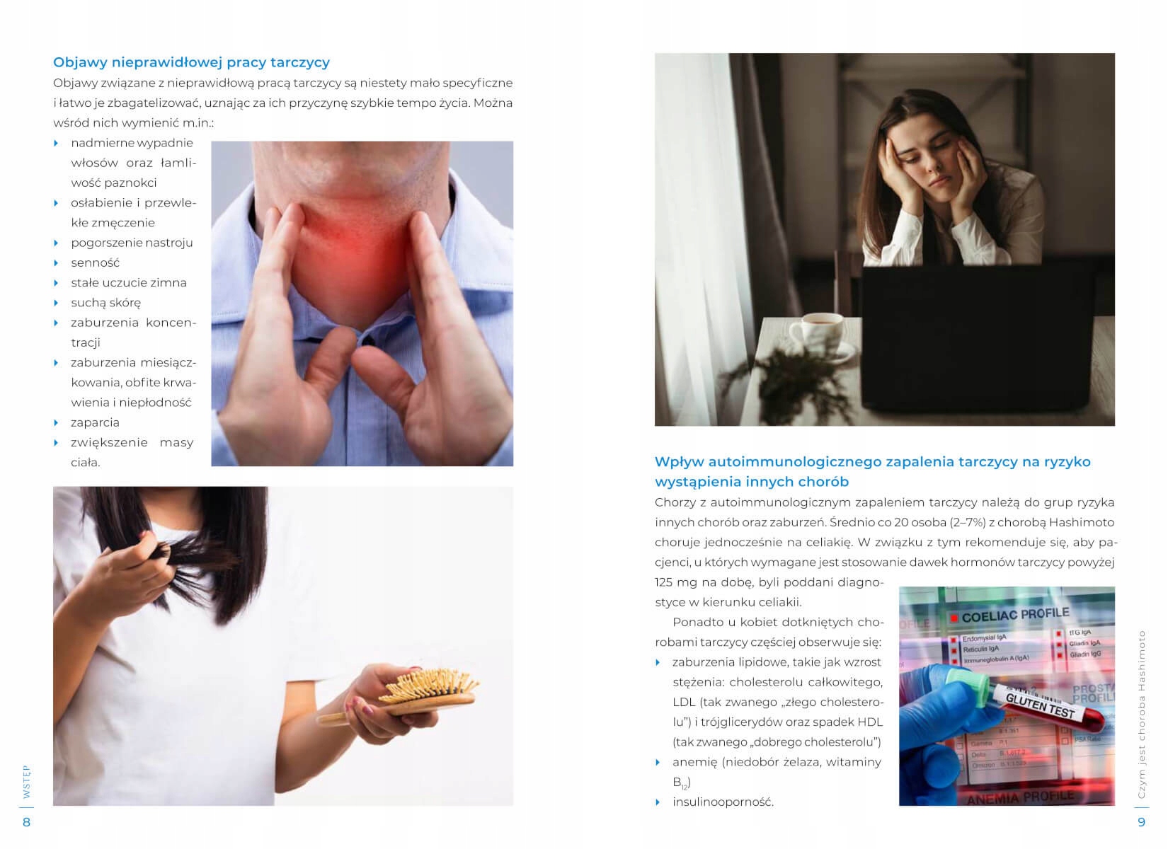 HASHIMOTO DIETA 100 PRZEPISÓW WZMOCNIJ TARCZYCĘ TWARDA ISBN 9788383481111