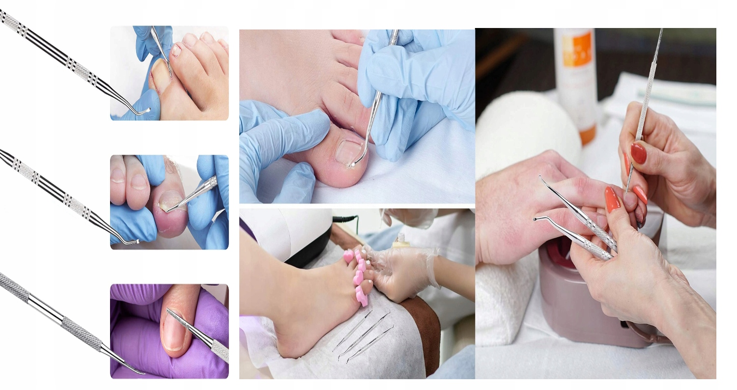 ZESTAW DO WRASTAJĄCYCH PAZNOKCI SONDA PODOLOGICZNA Rodzaj inny