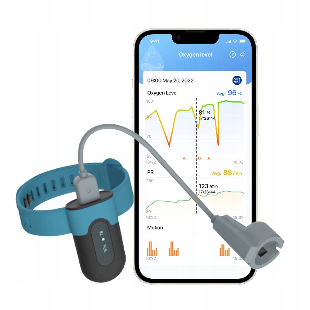 Монитор сна пульсоксиметр. Вибрация Сигнализации, Результаты Экспорта Приложения Bluetooth