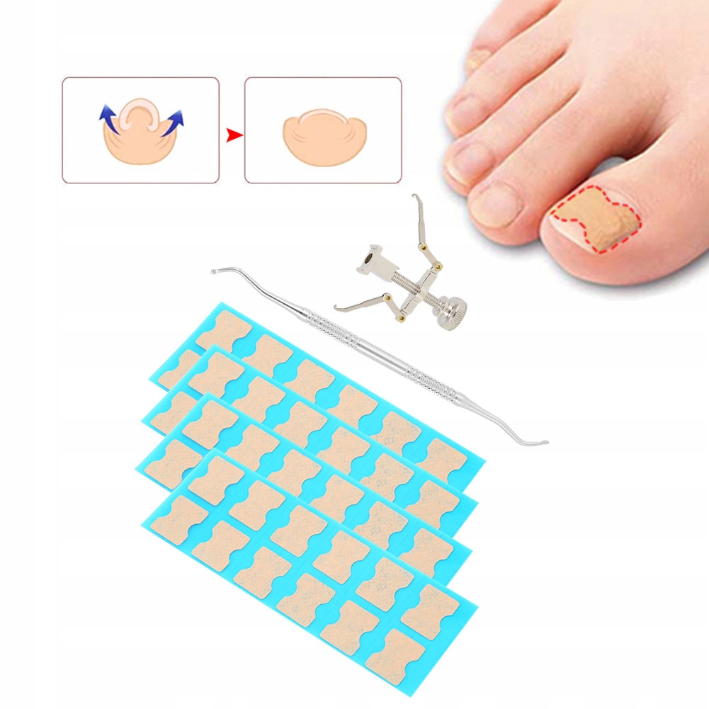 PASKI ŁATKI NA WRASTAJĄCE PAZNOKCIE PLASTRY 48SZT.