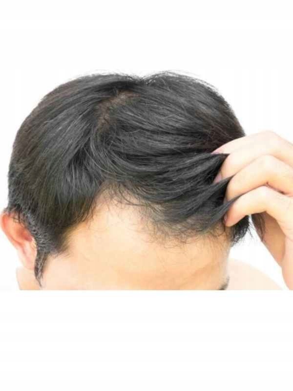 Tonik do włosów Alpecin 200 ml Rodzaj tonik