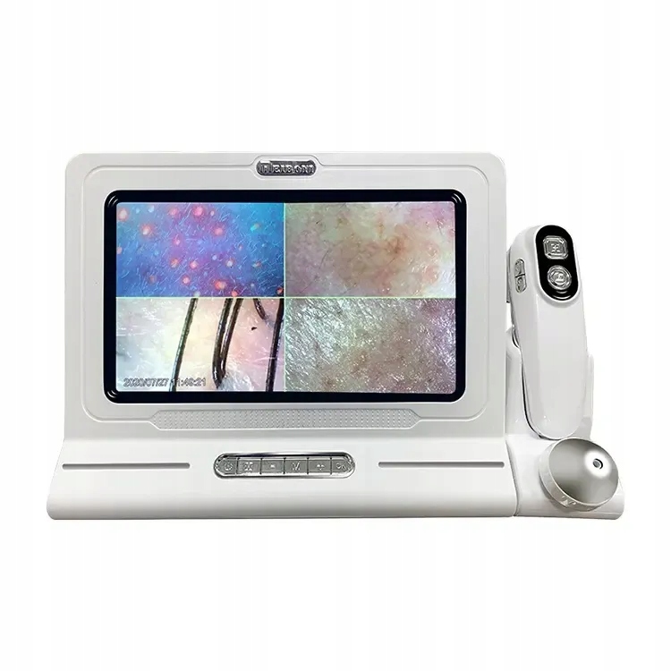 Detektor kůže hlavy Iqpro Analyzátor kůže Uv