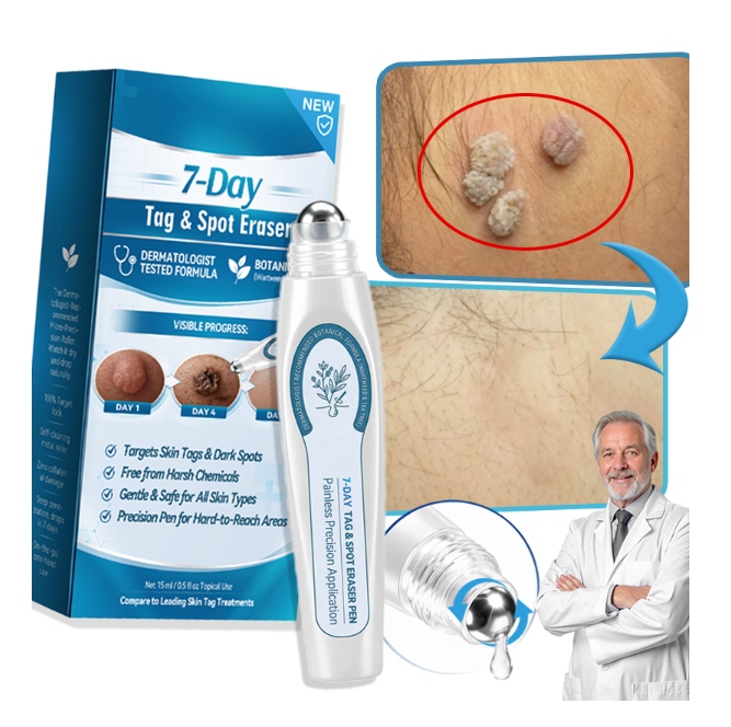 Silný Roztok Na Fibromy, Kuří Oka A Bradavice 15 ML (1 Ks)