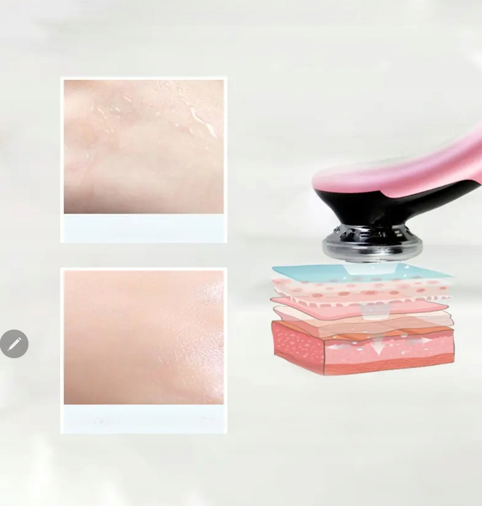 MEZOTERAPIA BEZIGŁOWA MASAŻER EMS DO TWARZY LIFTING MASAŻ RNMBEAUTY Marka inna marka