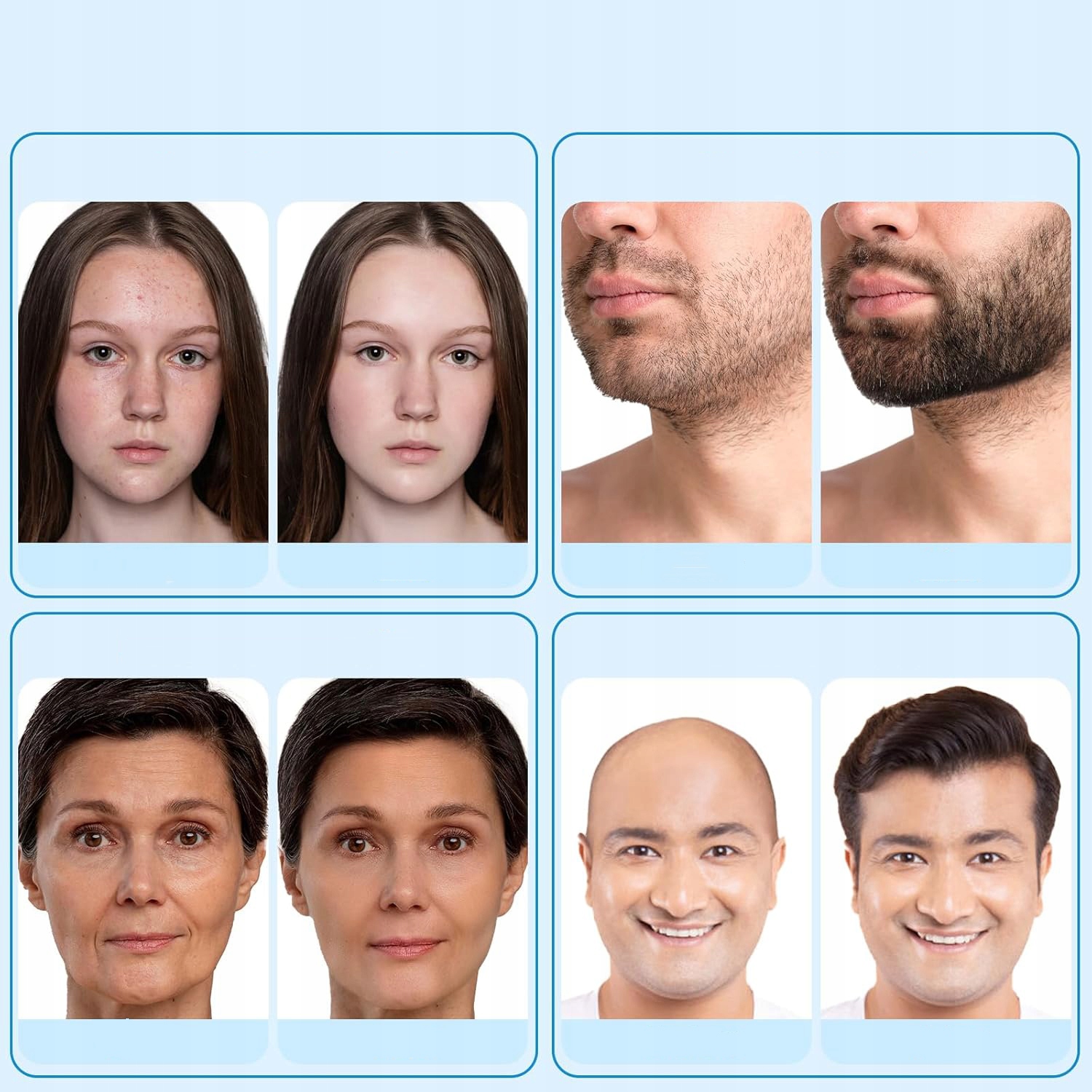 PROFESJONALNY STEMPEL DO PIELĘGNACJI SKÓRY DLA KOBIET 120 IGIEŁ MIKROIGŁY Długość igieł 2 mm