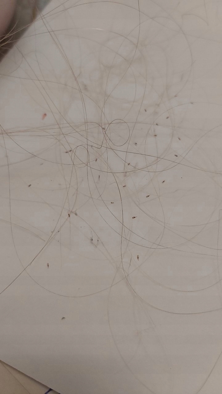 METALOWY GRZEBIEŃ NA WSZY I GNIDY TERMINATOR GĘSTY Wyrób medyczny nie