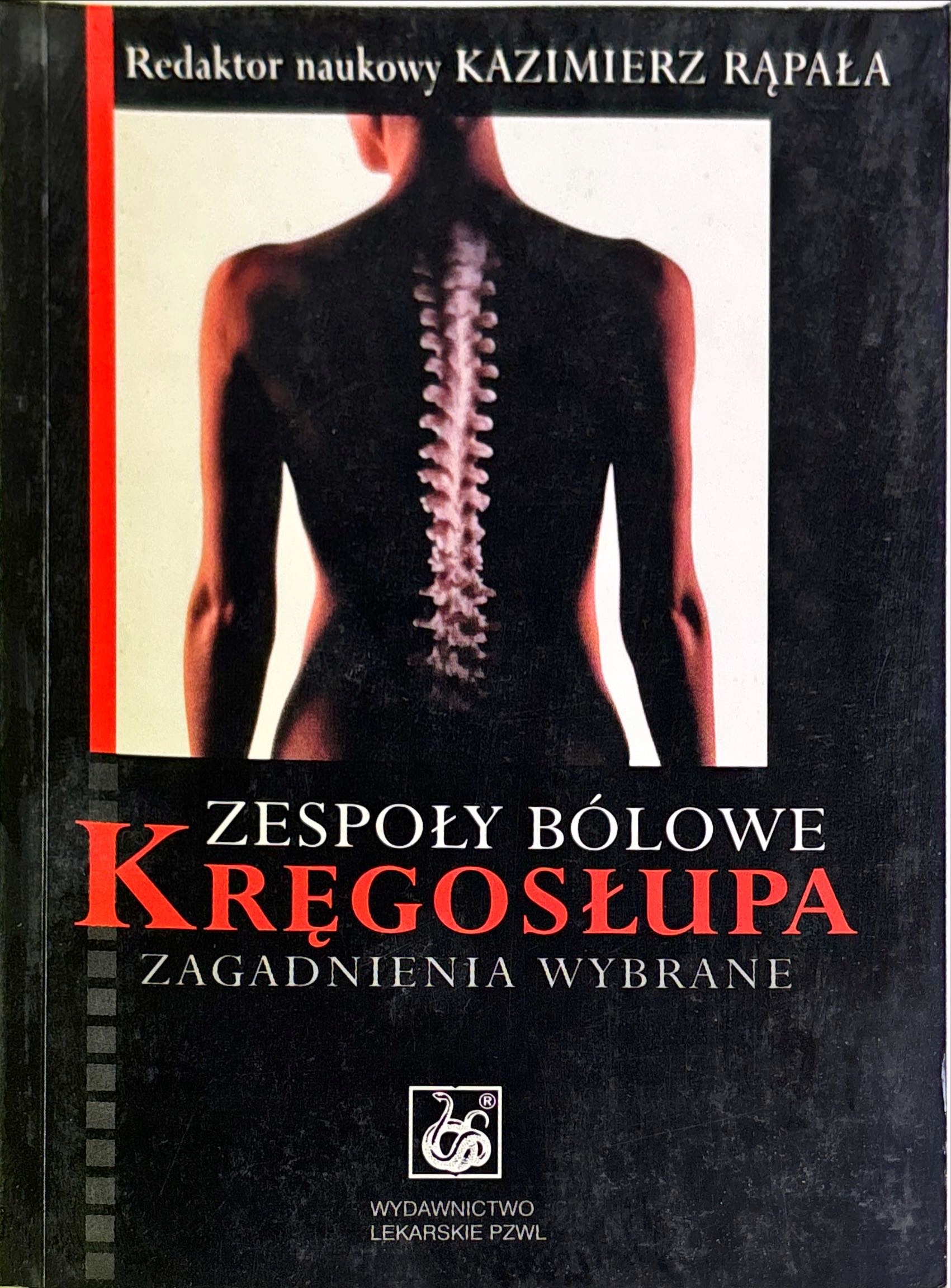 ZESPOŁY BÓLOWE KRĘGOSŁUPA