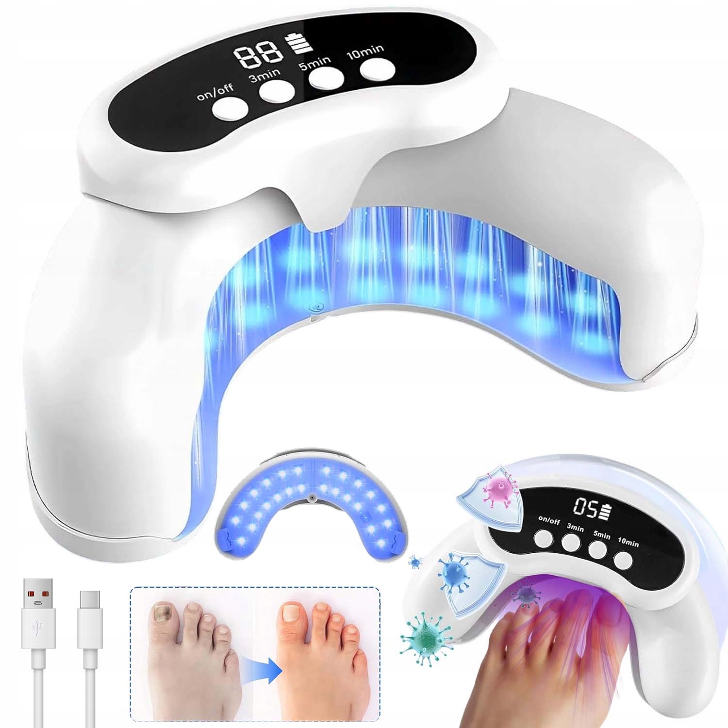 Protiplísňové Laserové Zařízení Pro Léčbu Mykózy Nehtů Na Nohou