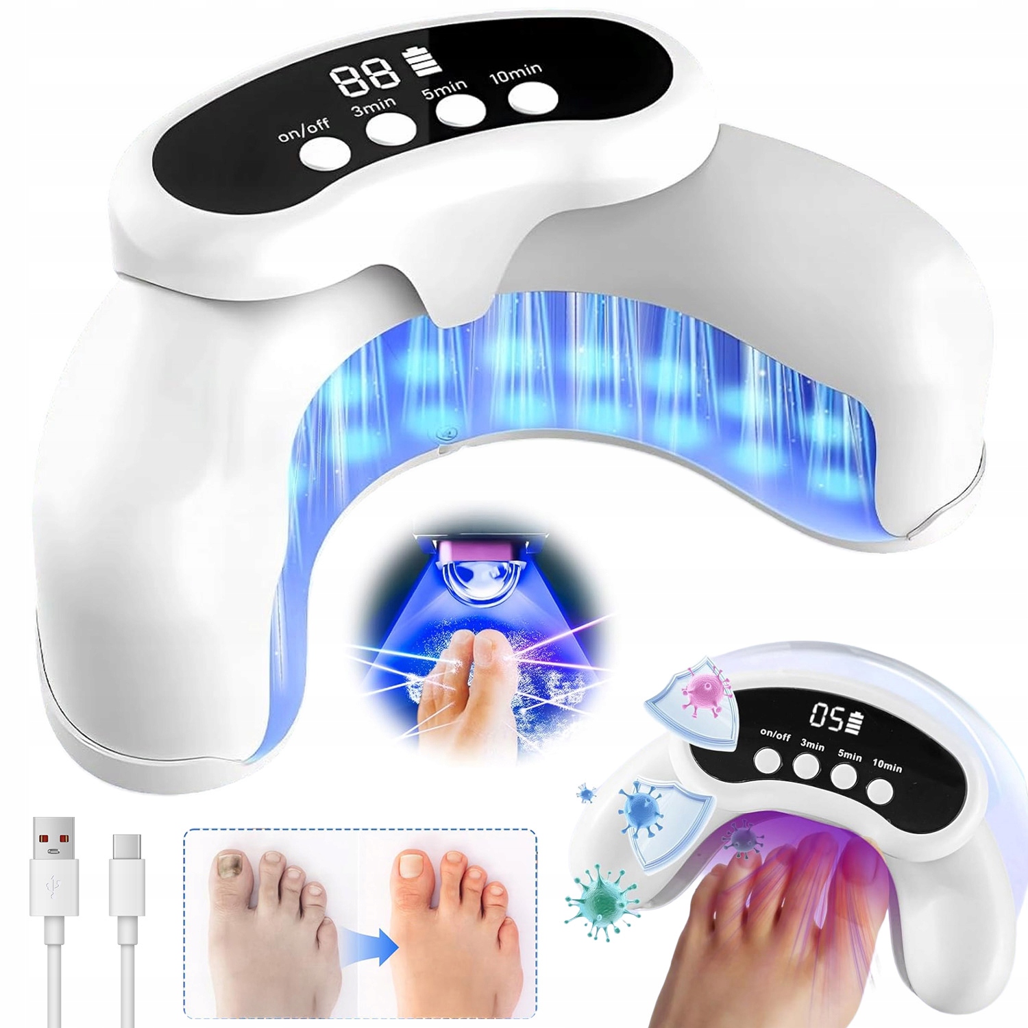 Laserové Zařízení Pro Léčbu Mykózy, Bezpečné Pro Ruce A Nohy