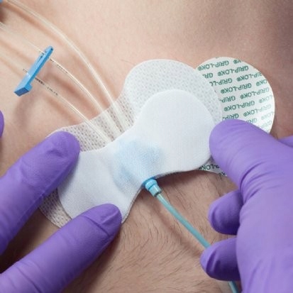 

Grip-Lok system mocowań cewników drenów 8,9cm