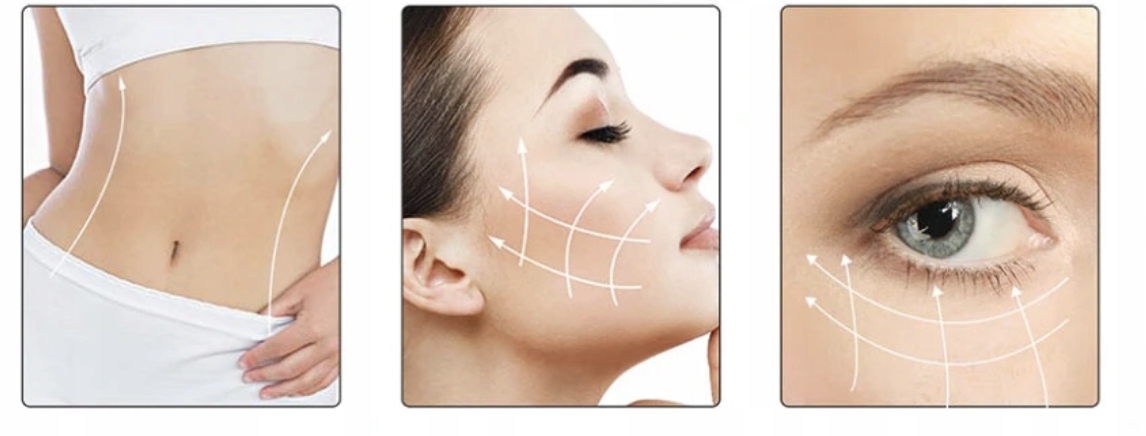 DO ODCHUDZANIA KAWITACJA LIPOSUKCJA ULTRADŹWIĘKOWA ANTYCELLULIT ZMARSZCZKI Opakowanie inny