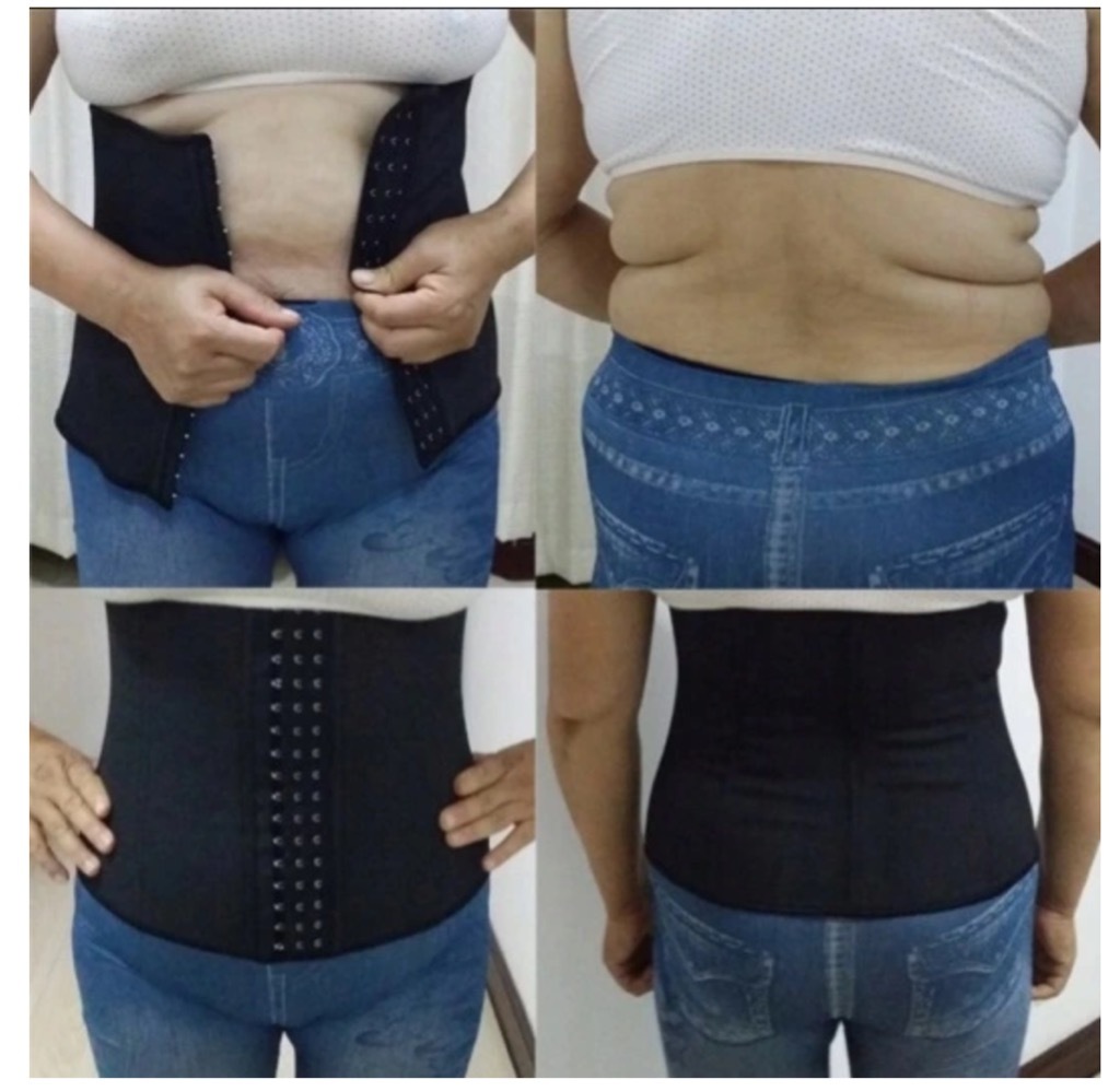 GORSET WYSZCZUPLAJĄCY!! *ZDJĘCIA PRZED I PO* | Sosnowiec | Ogłoszenie