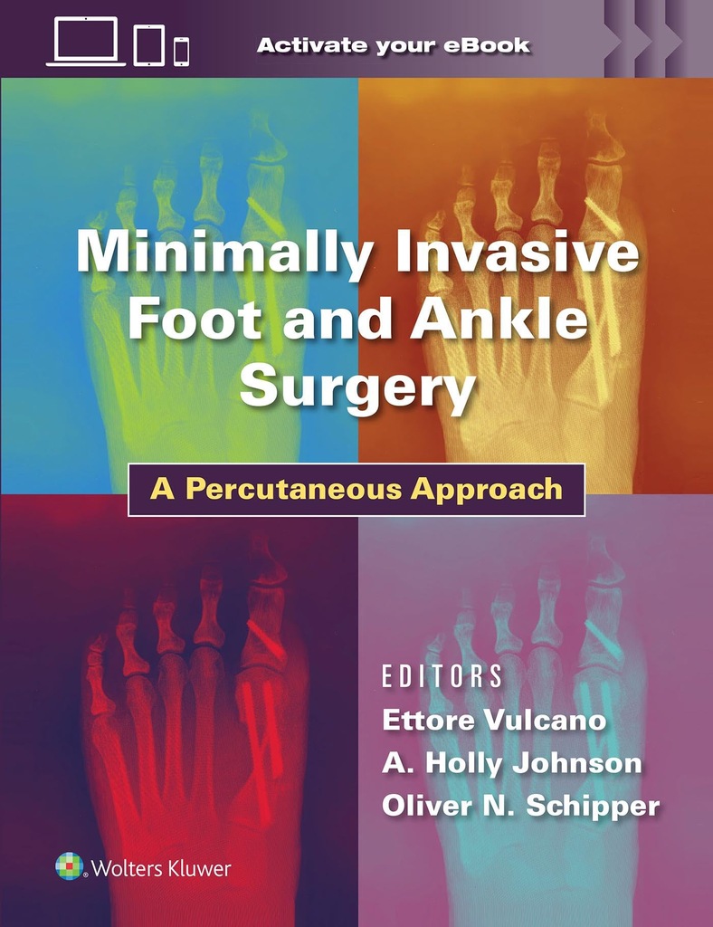 Lippincott Williams Wilki Minimally Invasive Foot