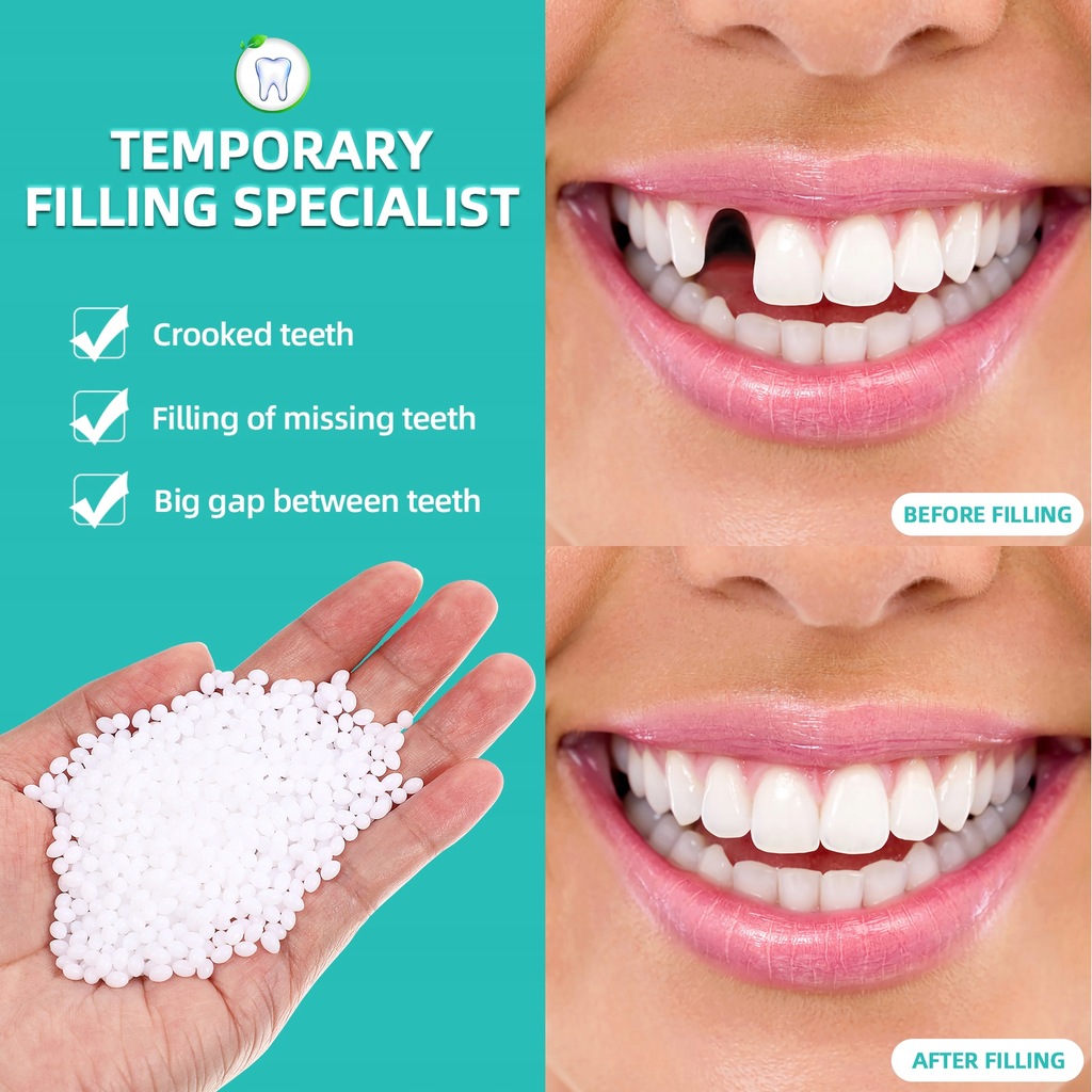 1 Pack Dental Repair Beads Teeth Cavity Filler - 14334163414 - oficjalne  archiwum Allegro