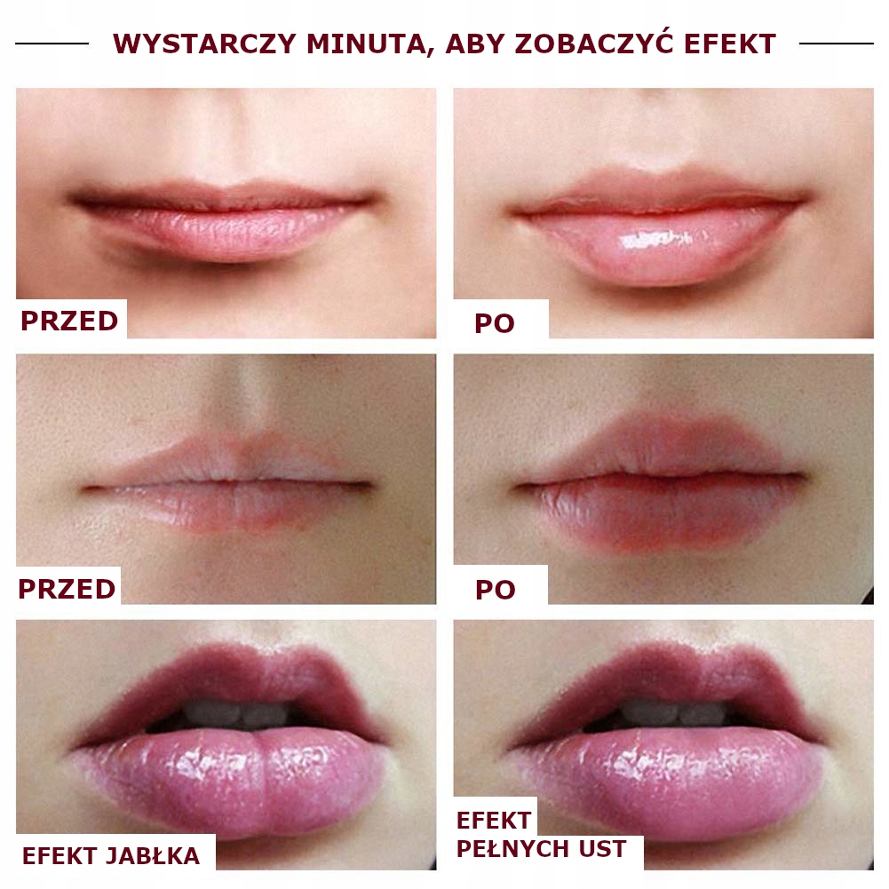 названия техник увеличения губ. техники введения филлеров в губы. натуральная форма губ. техники коррекции губ филлерами. форма губ для увеличения.