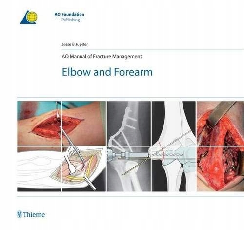 AO Manual of Fracture Management - Elbow & For